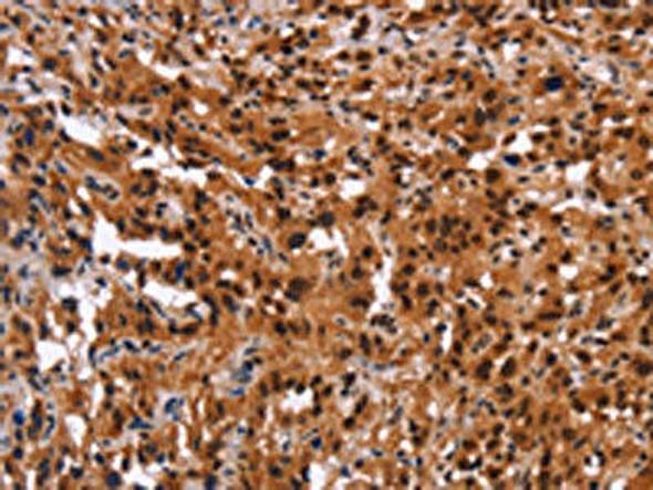 GPR124 Antibody (PACO19730)