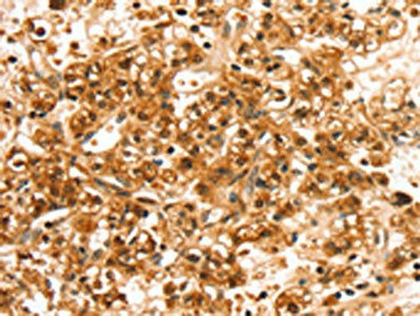 SLC44A2 Antibody (PACO20515)