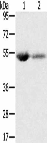 SLC13A3 Antibody (PACO20538)