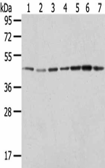 ERP44 Antibody (PACO20798)