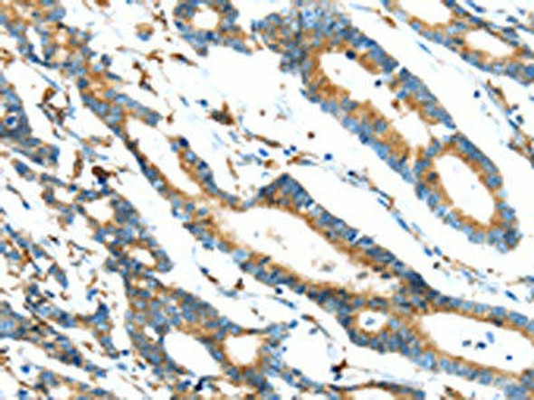ERP44 Antibody (PACO20799)