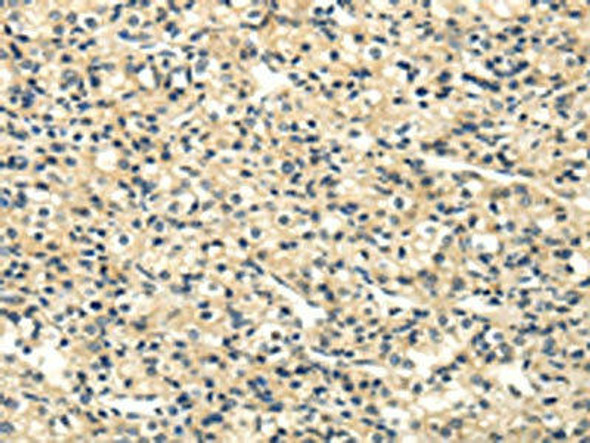 UHRF1BP1 Antibody (PACO20827)