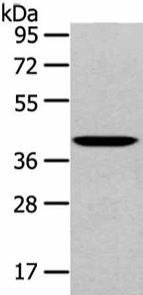 WNT10B Antibody (PACO20924)