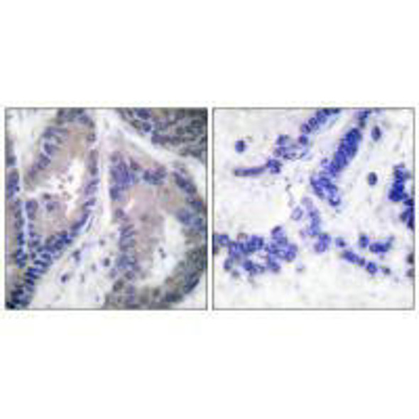 COL18A1 Antibody (PACO21651)