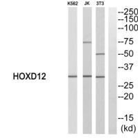HOXD12 Antibody (PACO21775)