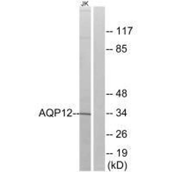 AQP12A Antibody (PACO22155)