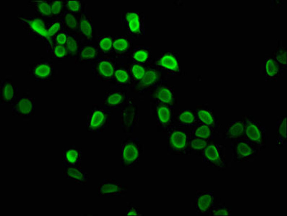 Mono-methyl-HIST1H4A (K5) Antibody (PACO58643)