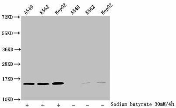 2-hydroxyisobutyryl-HIST1H2BC (K120) Antibody (PACO60480)