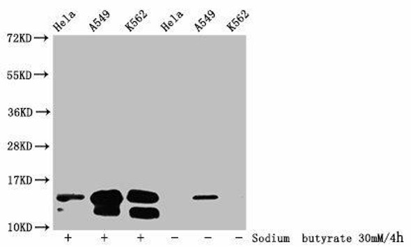 Butyrly-HIST1H2BC (K20) Antibody (PACO60483)