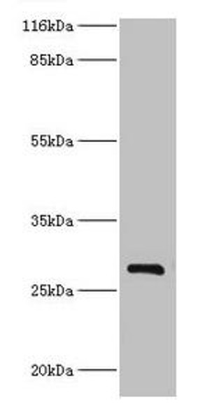 HSD17B14 Antibody (PACO40230)