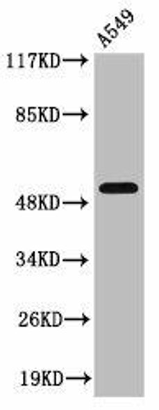 Cleaved-MMP17 (Q129) Antibody (PACO00035)