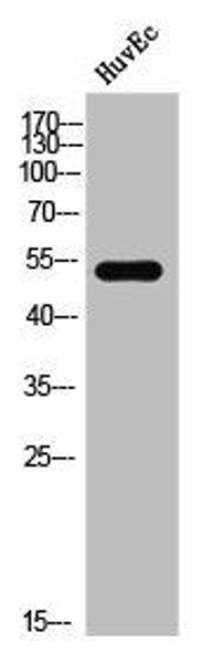 Phospho-DAPK3 (T265) Antibody (PACO02562)