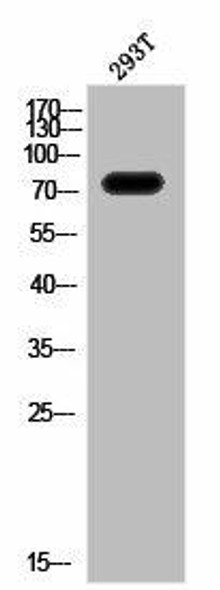 Phospho-IL2RB (Y364) Antibody (PACO02845)