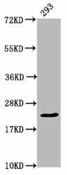 HIST1H1E (Ab-45) Antibody (PACO61894)