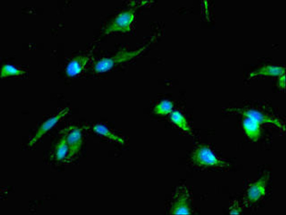 TP53I11 Antibody (PACO49070)