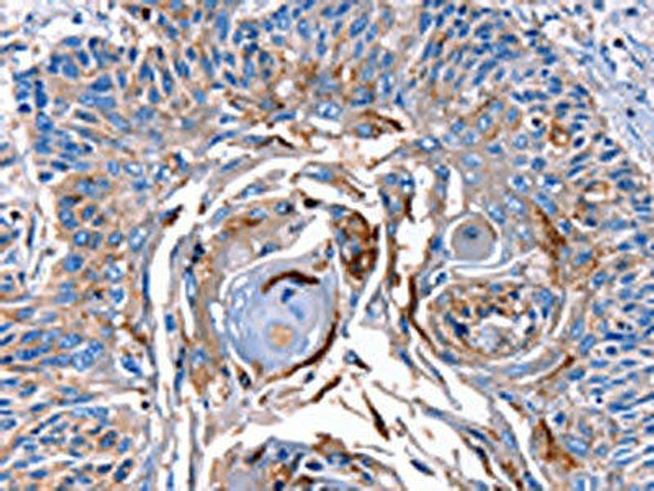 LRP2 Antibody (PACO18011)