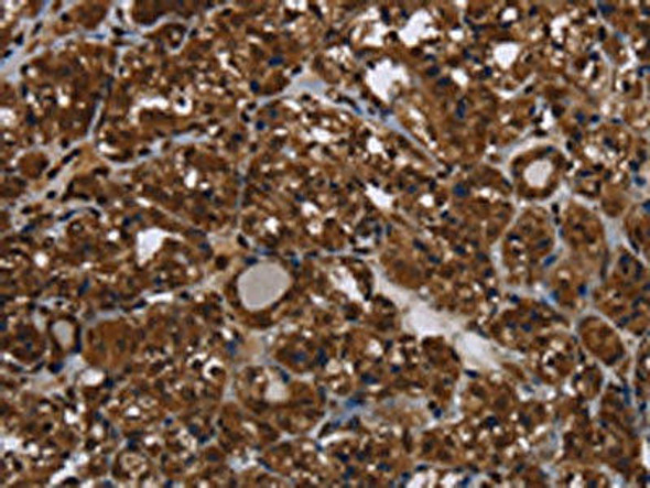 HDAC7 Antibody (PACO18063)