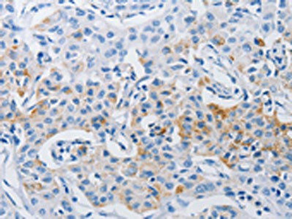LRIG1 Antibody (PACO18164)