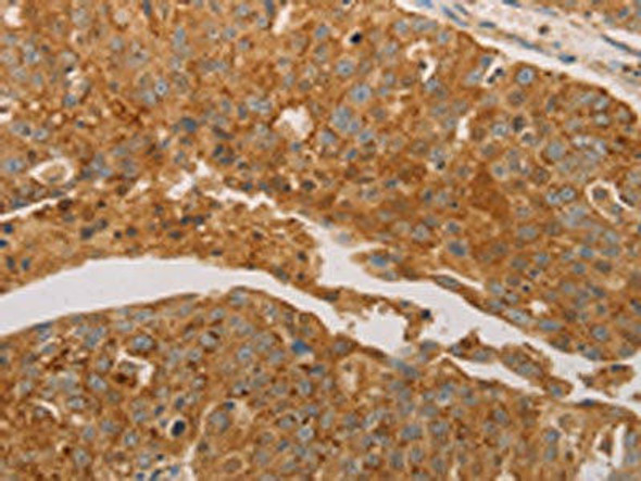 PRDX3 Antibody (PACO18370)