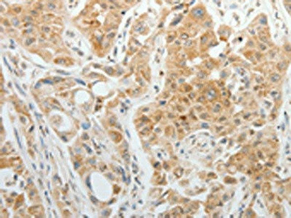 TTF2 Antibody (PACO18467)