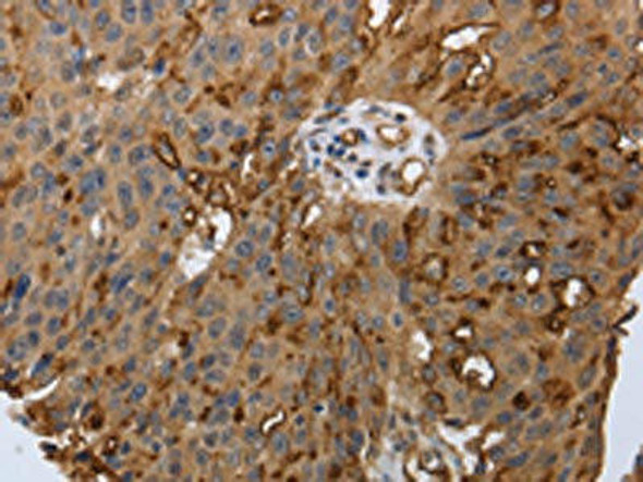 PODXL Antibody (PACO18821)