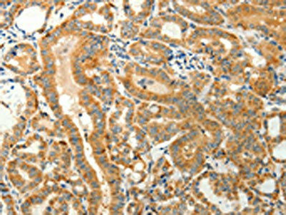 TMSB4X Antibody (PACO18983)
