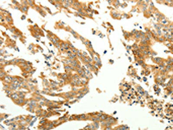 RARRES1 Antibody (PACO18984)