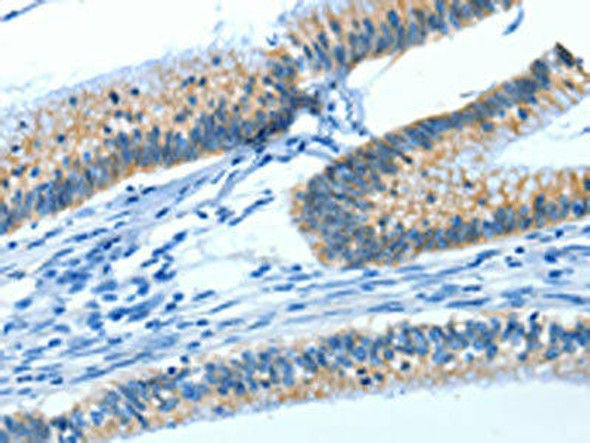 ATP1A1 Antibody (PACO19098)