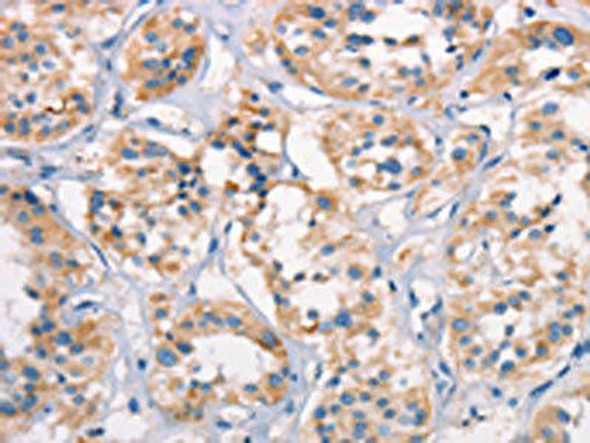 SPR Antibody (PACO19232)