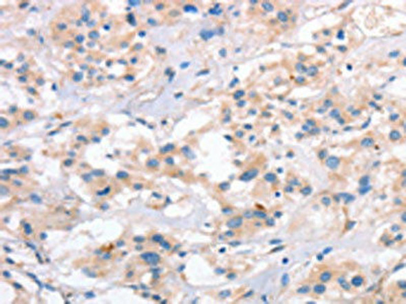 SLC4A1 Antibody (PACO19342)