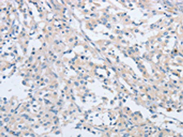 AGAP2 Antibody (PACO19466)