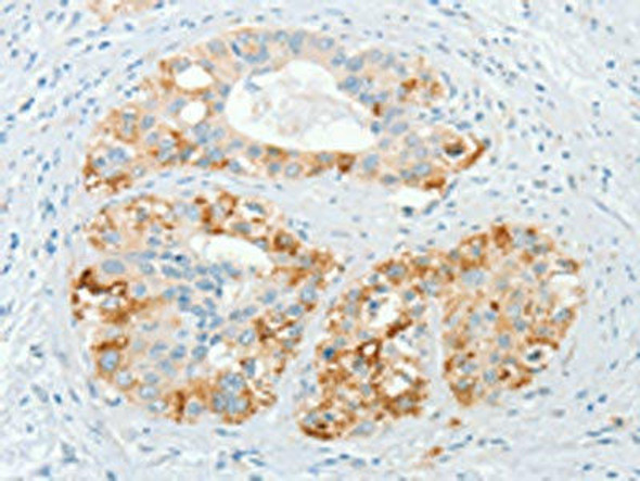 CHRDL2 Antibody (PACO19470)