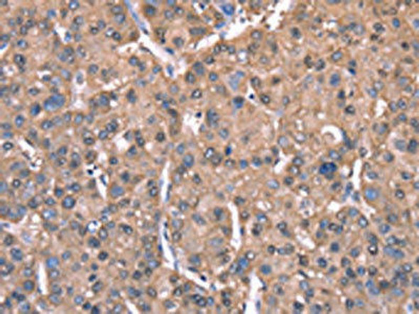SPAST Antibody (PACO19677)