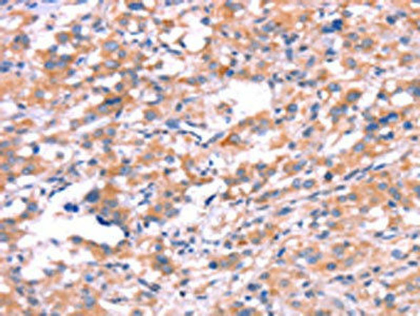 KCNJ6 Antibody (PACO19705)