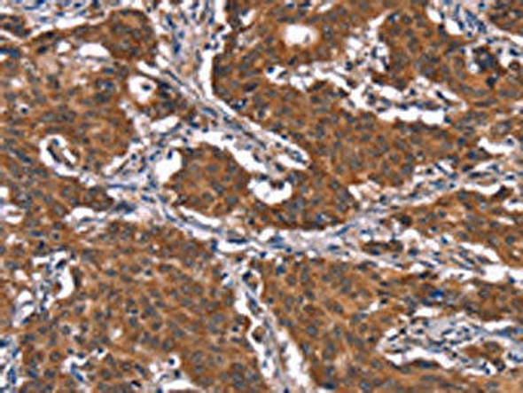 KCNJ9 Antibody (PACO19708)