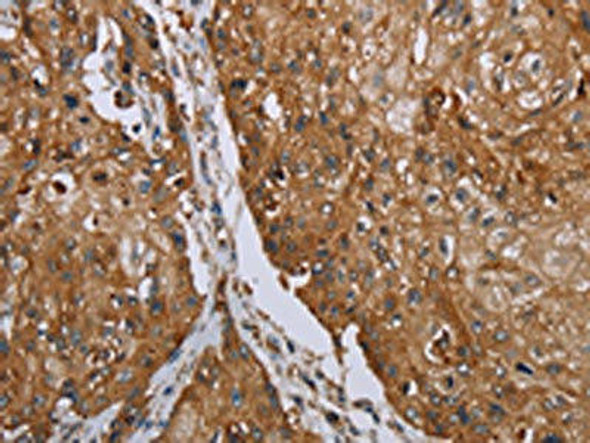 TNPO1 Antibody (PACO20024)