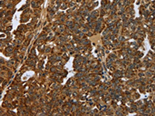 NEFH Antibody (PACO20084)