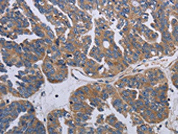 PARP4 Antibody (PACO20172)