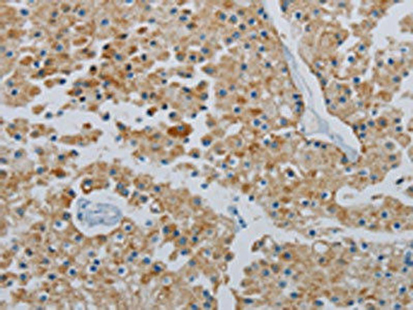 PPARGC1B Antibody (PACO20216)