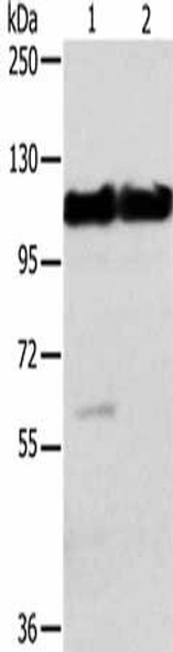 ACTN2 Antibody (PACO20392)