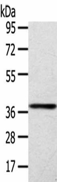 SIRT4 Antibody (PACO20469)