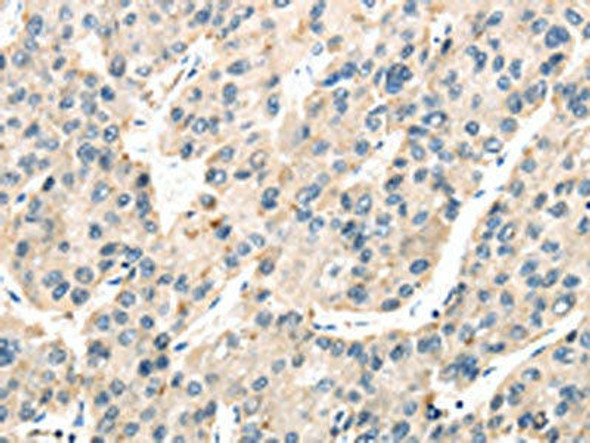 TXNIP Antibody (PACO20800)