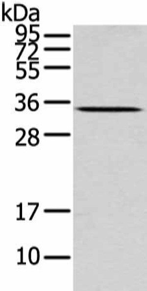 UCP2 Antibody (PACO20817)