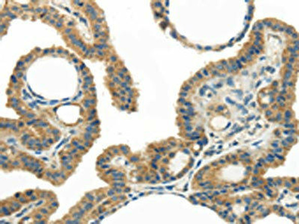 WISP1 Antibody (PACO20881)