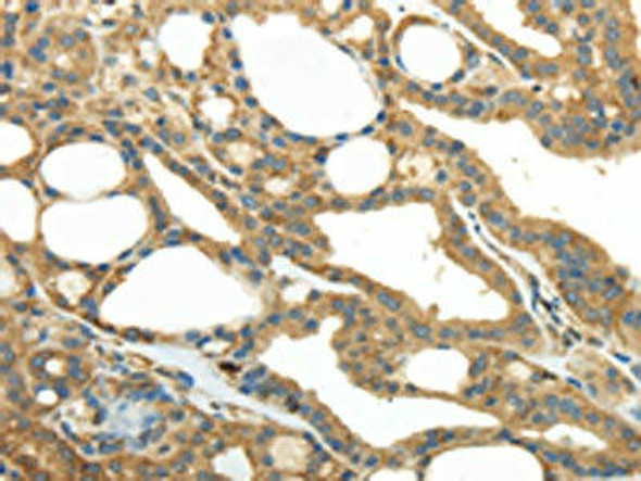 PKM Antibody (PACO20903)