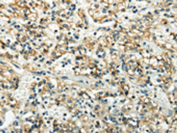 WNK3 Antibody (PACO20908)