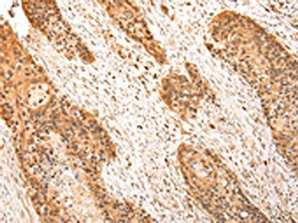 ZPR1 Antibody (PACO20954)