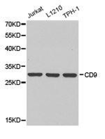 CD9 Antibody (PACO21184)