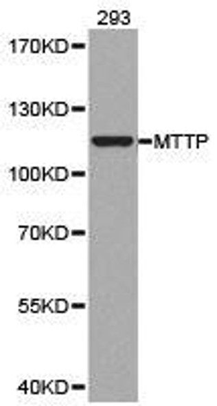 MTTP Antibody (PACO21194)