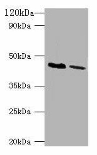 KCNJ1 Antibody (PACO27749)